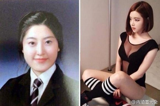 内涵图之韩国美女走红前后对比照